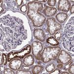 ATP5J2 Polyclonal Antibody