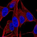 SERTM1 Antibody in Immunocytochemistry (ICC/IF)