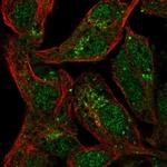 SPRY1 Polyclonal Antibody