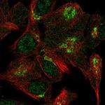 VPS54 Polyclonal Antibody