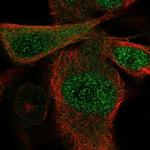 SSU72 Polyclonal Antibody