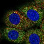 LPIN3 Polyclonal Antibody
