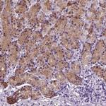 Hemicentin 2 Polyclonal Antibody