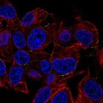 PKP4 Polyclonal Antibody