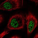 RBM25 Polyclonal Antibody