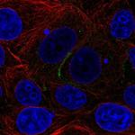 KIAA1324 Polyclonal Antibody