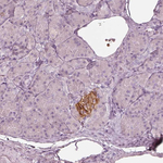 GPRIN1 Antibody in Immunohistochemistry (Paraffin) (IHC (P))
