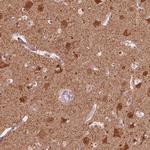 GPRIN1 Antibody in Immunohistochemistry (IHC)