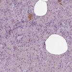 GPRIN1 Antibody in Immunohistochemistry (IHC)