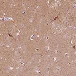 GPRIN1 Antibody in Immunohistochemistry (IHC)