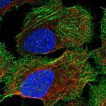 CORIN Antibody in Immunocytochemistry (ICC/IF)