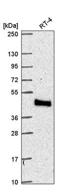 Mtmr9 Antibody in Western Blot (WB)