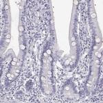 KRTAP16-1 Polyclonal Antibody