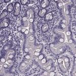 CCDC136 Antibody in Immunohistochemistry (Paraffin) (IHC (P))