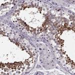 CCDC136 Antibody in Immunohistochemistry (IHC)