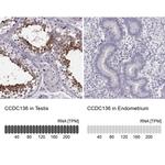 CCDC136 Antibody