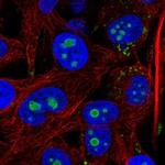 ACSL3 Polyclonal Antibody