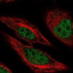 MACROD1 Polyclonal Antibody