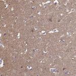 FRRS1L Antibody in Immunohistochemistry (IHC)