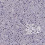 FRRS1L Antibody in Immunohistochemistry (IHC)
