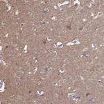 FRRS1L Polyclonal Antibody