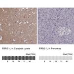FRRS1L Antibody
