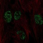 FICD Polyclonal Antibody