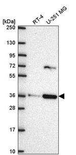 SCAMP3 Antibody in Western Blot (WB)