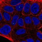 TIGD2 Polyclonal Antibody