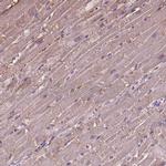 CRYBA4 Polyclonal Antibody