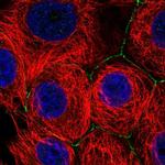 SLC2A11 Polyclonal Antibody