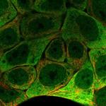 SCNN1G Polyclonal Antibody