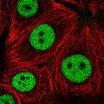 ZNF335 Polyclonal Antibody