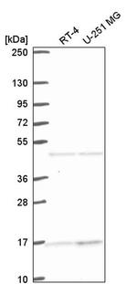 ACTR10 Antibody in Western Blot (WB)