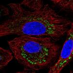 DPY19L2 Polyclonal Antibody