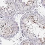 FAM205A Antibody in Immunohistochemistry (IHC)