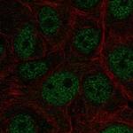 E4F1 Polyclonal Antibody