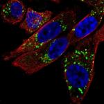 NIPA2 Polyclonal Antibody