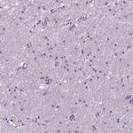 CD179b Antibody in Immunohistochemistry (IHC)