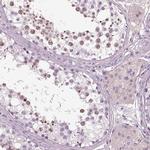 CD179b Polyclonal Antibody