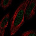 ZNF621 Polyclonal Antibody