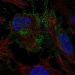 CYFIP2 Polyclonal Antibody