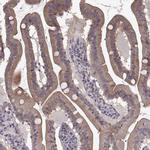SLC22A18 Antibody in Immunohistochemistry (IHC)