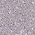 SLC22A18 Antibody in Immunohistochemistry (IHC)