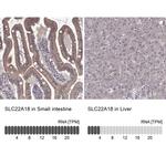 SLC22A18 Antibody
