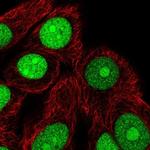 TNPO2 Polyclonal Antibody