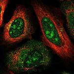 DOCK4 Polyclonal Antibody