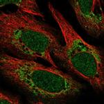 POLD4 Polyclonal Antibody