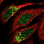 ZNF398 Polyclonal Antibody