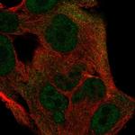 ITGB1BP1 Polyclonal Antibody